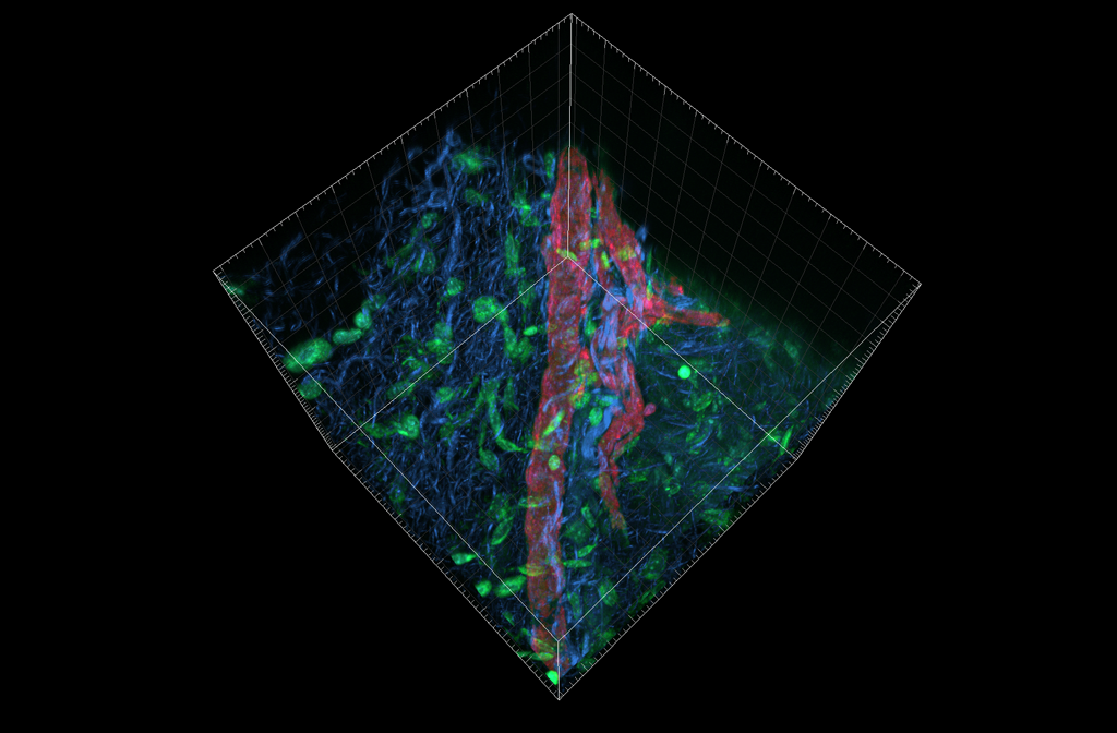 Blood vessel imaging in skin