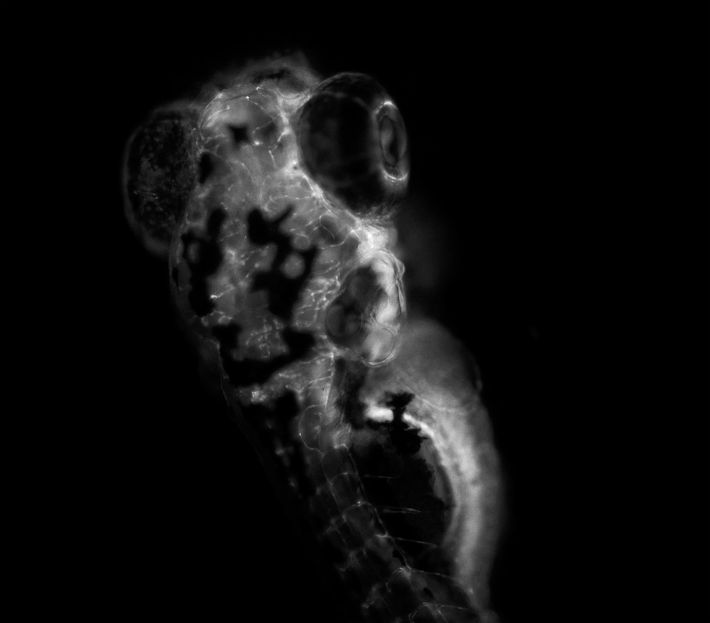 Zebrafish movements